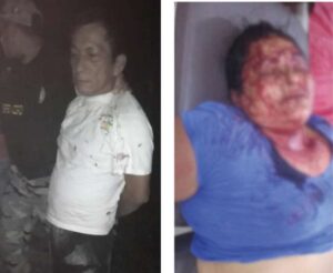 Sujeto golpea con llave stilson a su conviviente