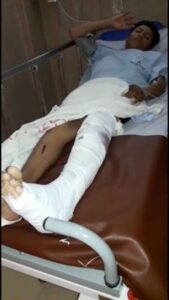 En circuito privado, Motocrosista atropella a padre de familia