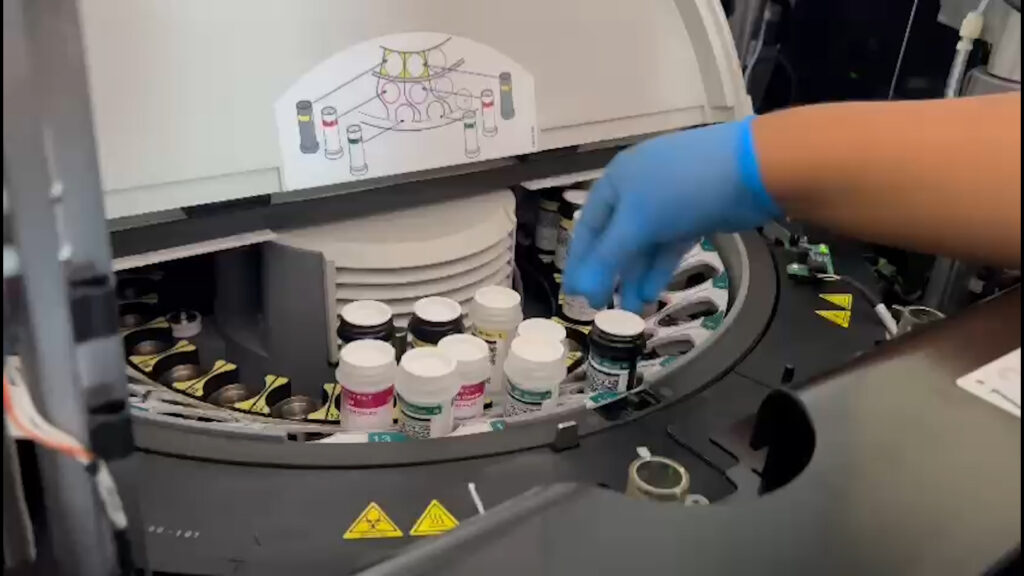 Banco Regional de Sangre en alerta por desabastecimiento de insumos para transfusiones