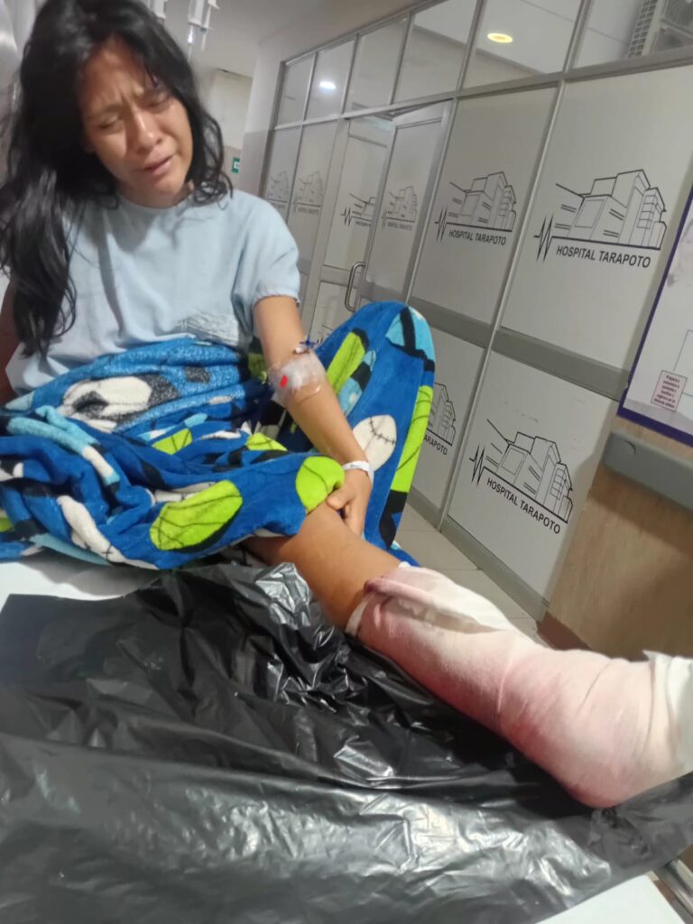 Joven resulta gravemente herida tras ser atropellada por motocicleta en Shapaja