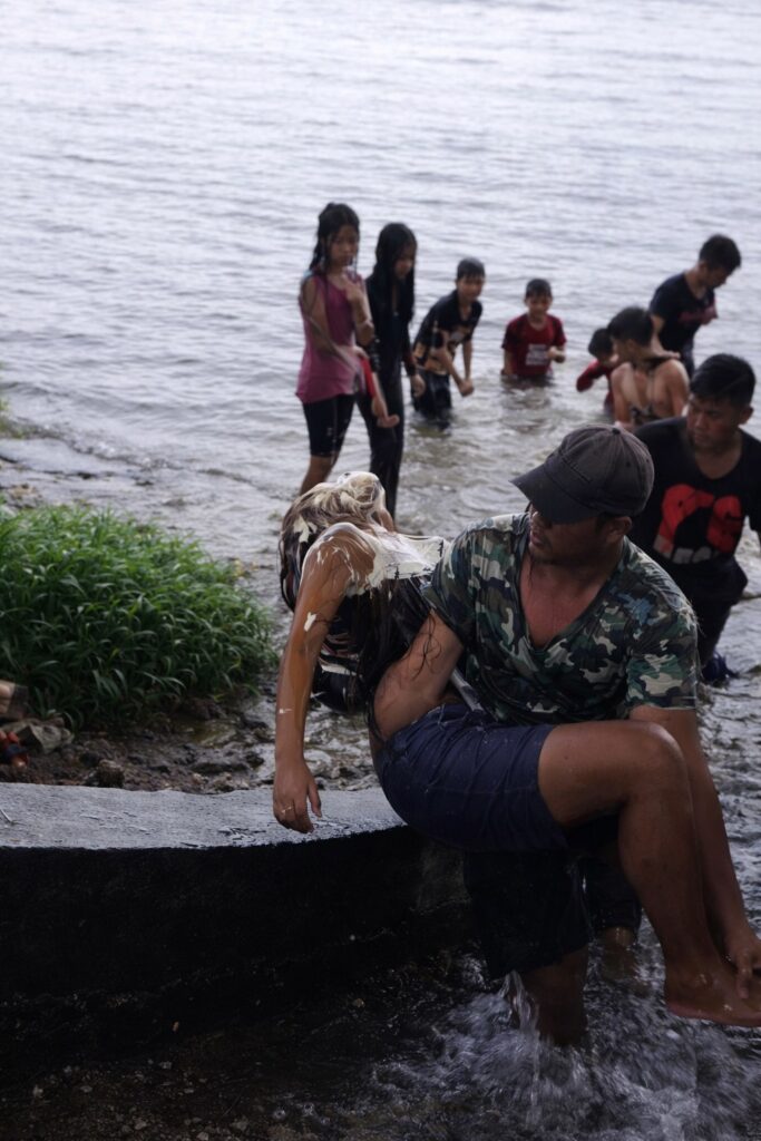 Ataque con sustancia química deja a adolescente afectada durante celebración de carnaval en Picota