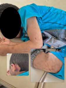 Justicia para Thiago: el clamor que conmueve a Moyobamba y sacude a todo San Martín