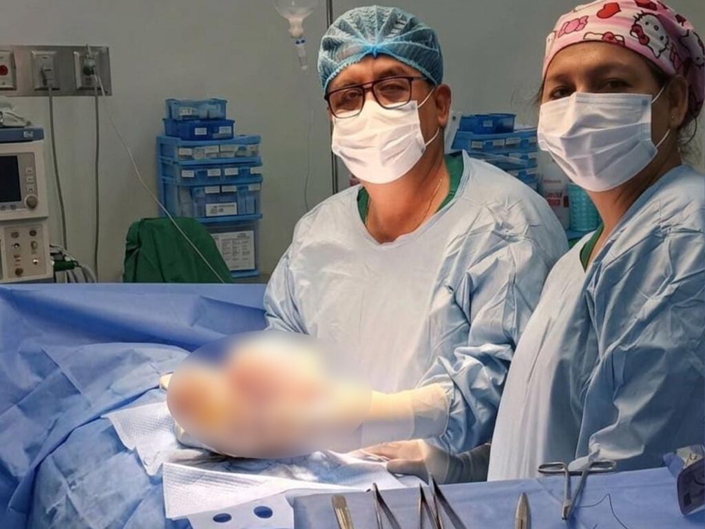 Médicos del Hospital II-E Juanjuí salvan la vida de paciente tras cirugía de alta complejidad