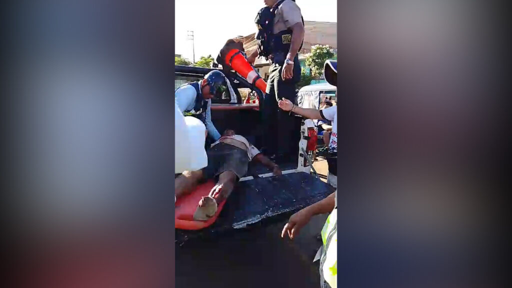 Adulto mayor resulta herido tras ser atropellado en La Banda de Shilcayo