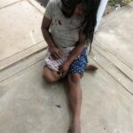 Mordedura de víbora expone grave crisis sanitaria en Jeberos: Mujer llegó a centro de salud y no encontró personal
