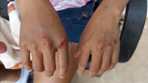 Mujer resulta herida tras presuntos piques ilegales realizados por jóvenes motociclistas