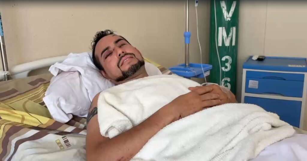 Animador de eventos queda con fracturas tras accidente en La Banda de Shilcayo