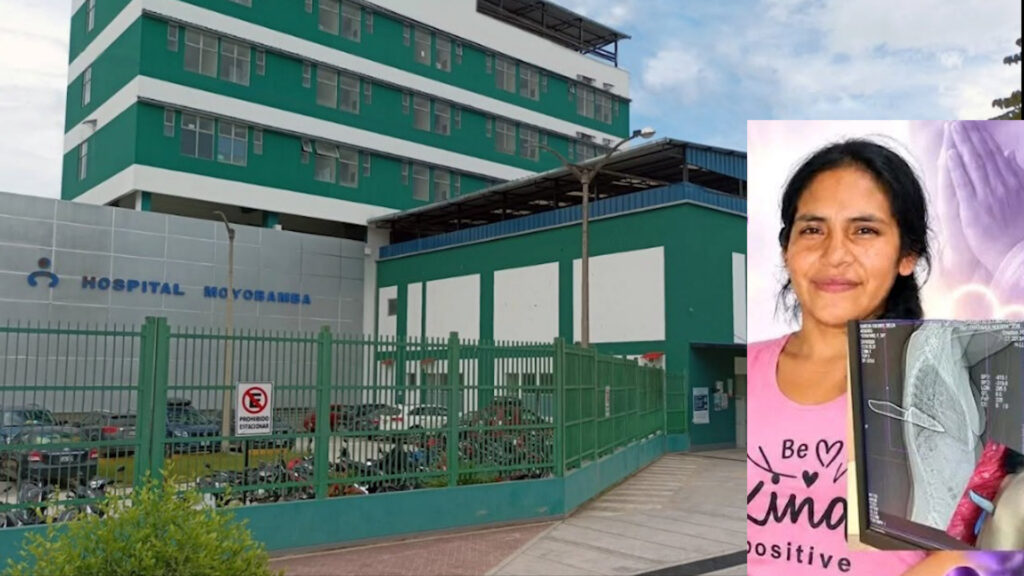 Mujer atacada presuntamente por su expareja permanece en UCI en Moyobamba